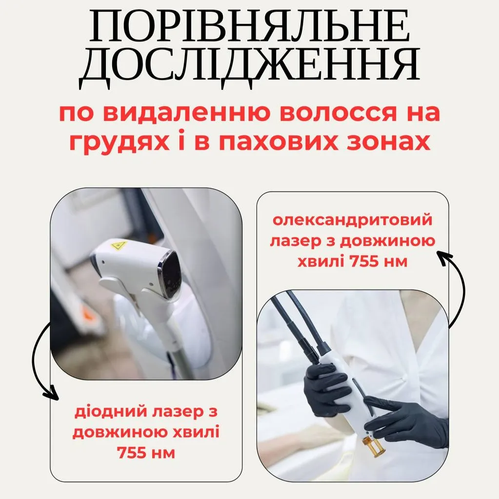 Діодний лазер 755 нм проти олександритового — порівняння ефективності епіляції грудей і пахв
