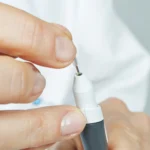 Встановлення голки SOFTOUCH в тримач апарату для електроепіляції